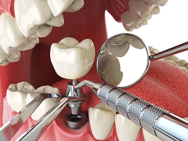 Best Emergency Orthodontic Repairs in Woodworth, OH